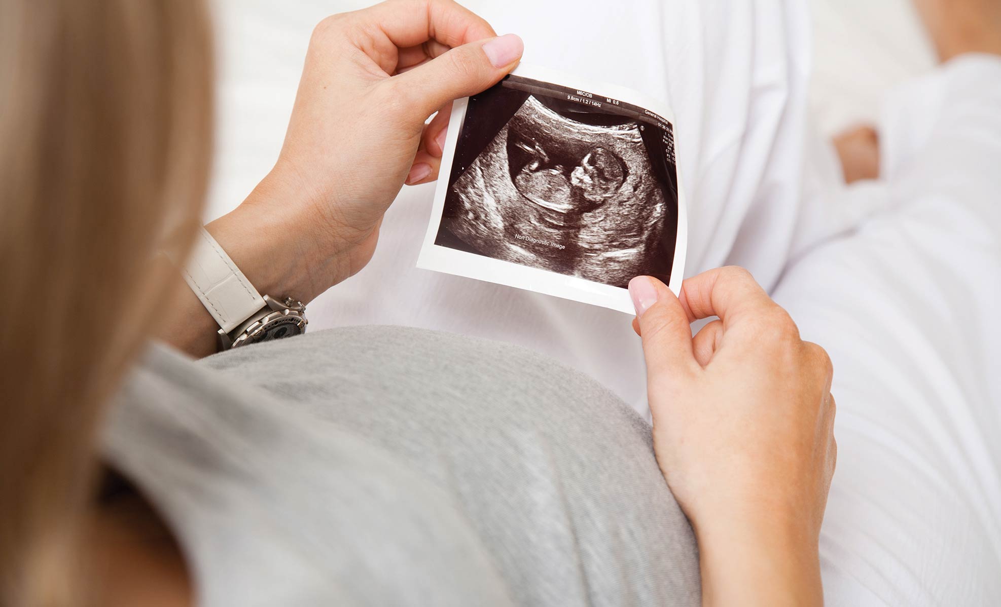 pregnant woman looking at ultrasound photo